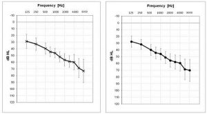 Speech-Recognition-Benefit-mean-audiogram-hearing-impaired-site-1