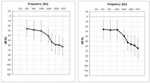 Speech-Recognition-Benefit-mean-audiogram-hearing-impaired-site-2