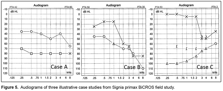 A-New Wireless-CROS-and-BiCROS-Solution_5